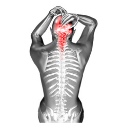 3D render of a female figure  with head and neck pain