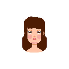 Woman with  psoriasis, symptom of SLE, rosacea . Vector illustration