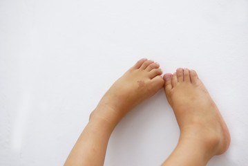 Child Foot Over White Background