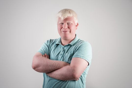 Albino young man portrait. Smiling man isolated at white background