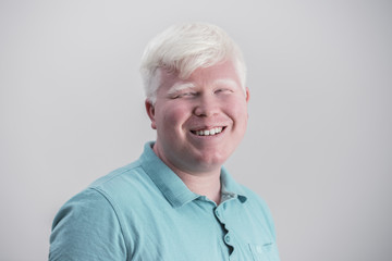 Albino young man portrait. Smiling man isolated at white background - obrazy, fototapety, plakaty