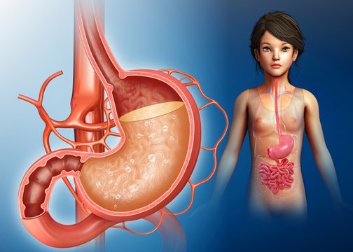 Child with stomach acidity, illustration