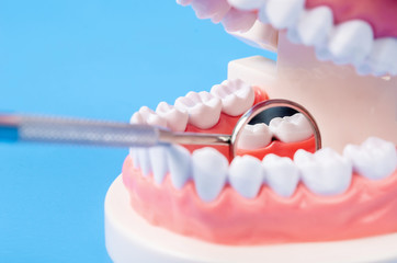 Fototapeta na wymiar Tooth dental caries on denture with equipment.