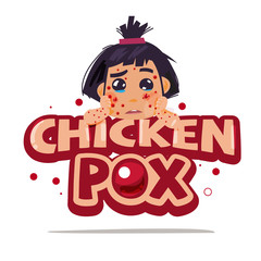 chickenpox. logotyle. typography - vector