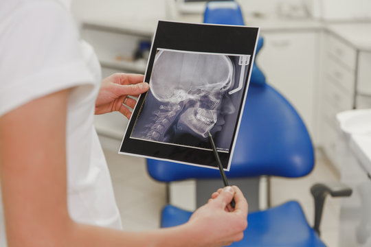 A female dentist holds an X-ray photo of a human skull from a profile in the dental office
