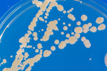 Pile petri dish with growing cultures of microorganisms in doctor hand , fungi and microbes. A Petri dish  ( Petrie dish. Petri plate or cell-culture dish)