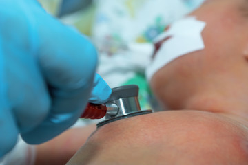 Fototapeta premium Doctor holding stethoscope in his hand and doing auscultation newborn baby on breathing machine