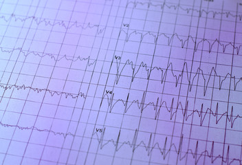 Electrocardiogram chart as medical background