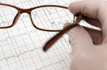 The hand in the white medical glove holds the glasses. Electrocardiogram graph (ECG)