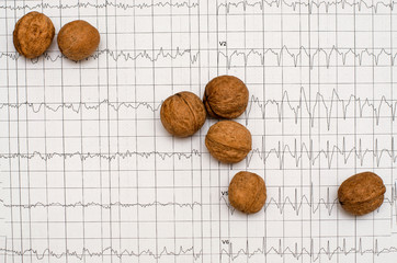 Electrocardiogram graph (ECG), heart analysis. Walnuts