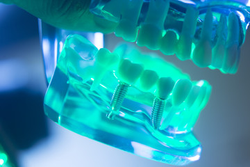 Dental oral teeth model