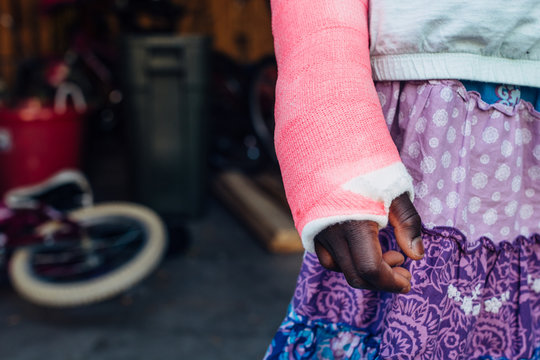 Pink cast on a broken arm of an African American girl