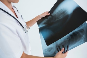 Mid section of female doctor examining X-rays - Powered by Adobe