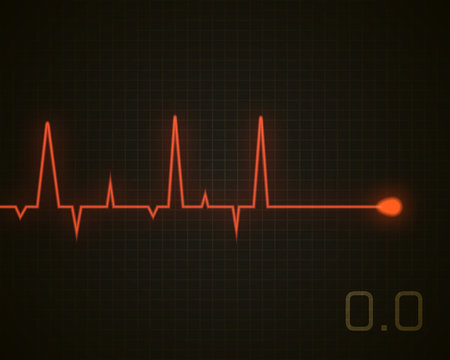Heart beat dead graphic. Vector heart pulse isolated on black.