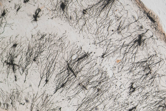Close-up of rat's nerve cell