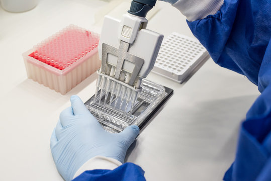 Female scientist on a laboratory working with a multi-pipette and a DNA chip