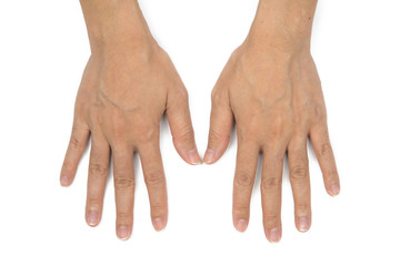 Asian hands with clear veins