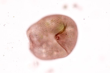 Stentor, sometimes called trumpet animalcules, are a genus of filter-feeding, heterotrophic ciliates, representative of the heterotrichs in waste water under the microscope.