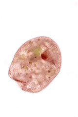 Stentor, sometimes called trumpet animalcules, are a genus of filter-feeding, heterotrophic ciliates, representative of the heterotrichs in waste water under the microscope.