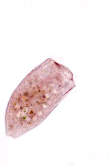 Stentor, sometimes called trumpet animalcules, are a genus of filter-feeding, heterotrophic ciliates, representative of the heterotrichs in waste water under the microscope.