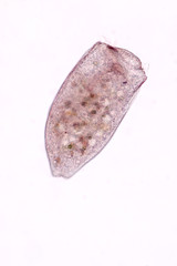 Stentor, sometimes called trumpet animalcules, are a genus of filter-feeding, heterotrophic ciliates, representative of the heterotrichs in waste water under the microscope.