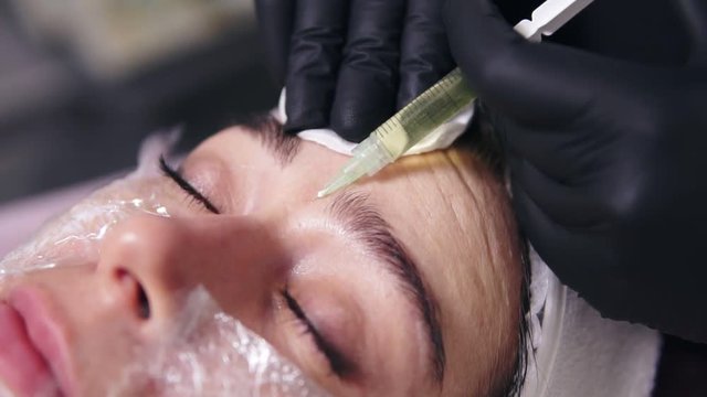 Doctor makes multiple injections in woman's face skin during mesotherapy. Biorevitalization and face lifting, non-surgical cosmetic medicine treatment