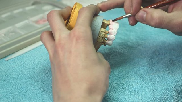 Dentist prepare model of the human jaw