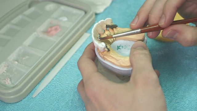 Dental technician making teeth implant