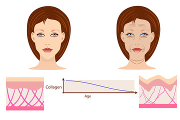 Vector faces and two types of skin - aged and young for medical and cosmetological illustrations