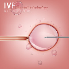 In Vitro Fertilization