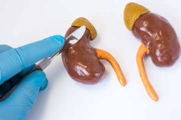 Kidney surgery concept photo. 3D anatomical shape of kidneys with adrenal glands next to  surgeon...