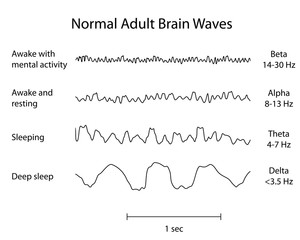 Normal Brain Waves EEG
