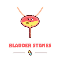 Bladder stone disease awareness poster. Cute sad unhealthy bladder icon made in cartoon style. Human body organs anatomy sign on white background. Medical internal organ symbol. Vector illustration.