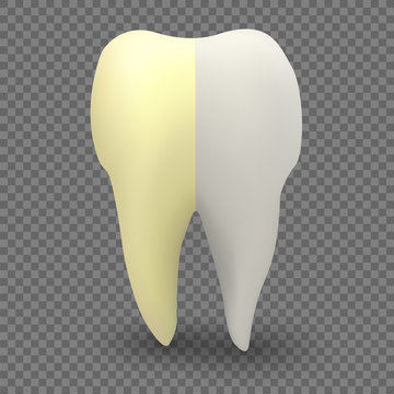 Tooth, teeth before and after whitening, dental care, vector illustration