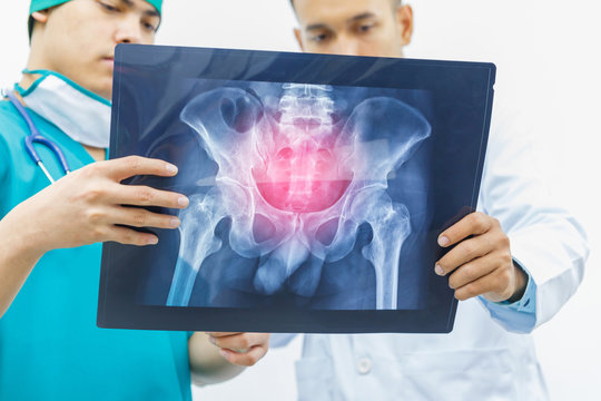 Two doctors are diagnosing the symptoms of a patient from x-ray at hip bone.