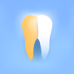 Teeth whitening illustration. Yellow sick tooth layer with shadow on a crystal white tooth. Vector glowing effect and shadow.