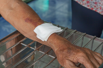 Abrasion wound arm