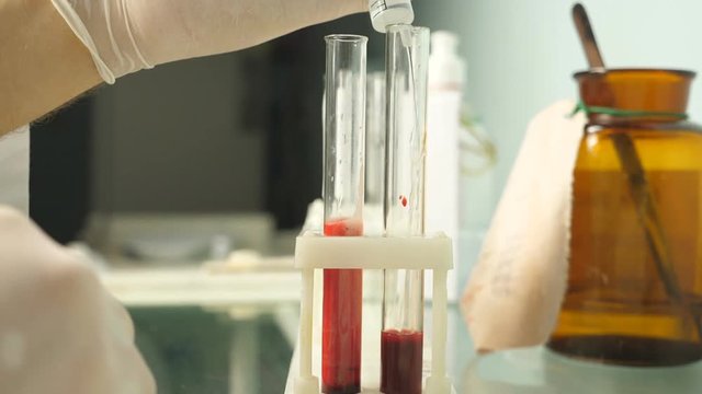 Testing a blood sample. Hand of male doctor in laboratory add hydrogen peroxide in test tube with blood. Close up Slow motion