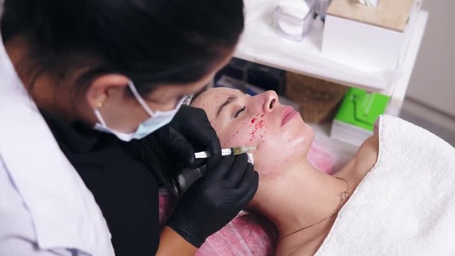 Rejuvenating procedures: professional cosmetologist makes multiple injections in woman's face skin during mesotherapy. Biorevitalization and face lifting