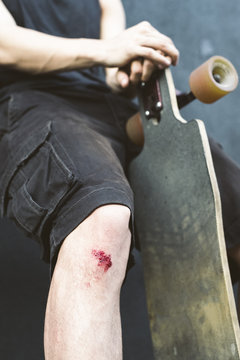 Skater knee wound