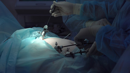 Operation using laparoscopic equipment. Surgeons team working with of patient in surgical operating...