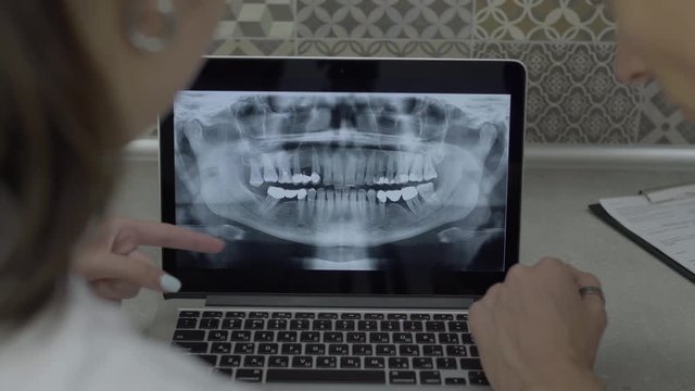 Two doctors analyzing X-ray image of teeth on laptop