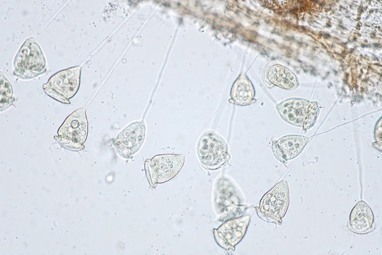 Vorticella is a genus of protozoan under microscope view.