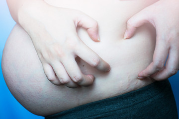 Pregnant woman scratching her belly. Pregnancy stretch marks. Itchy skin during pregnancy.