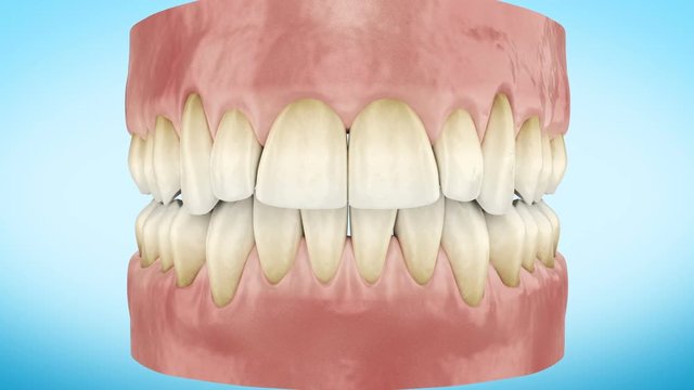 Dirty Yellow Teeth Zoom Close Up 3d Animation. Alpha Channel. Full HD 1920x1080.
