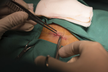 Doctor suturing the wound