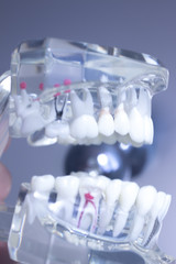 Dental teeth mouth model