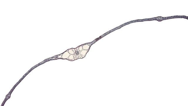 cross section cut of elodes leaf under the microscope