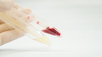 Urine analysis on white.