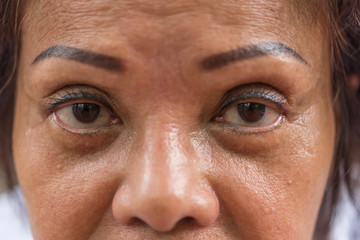 Asian elder women show her eyes and eyebrow tattoo